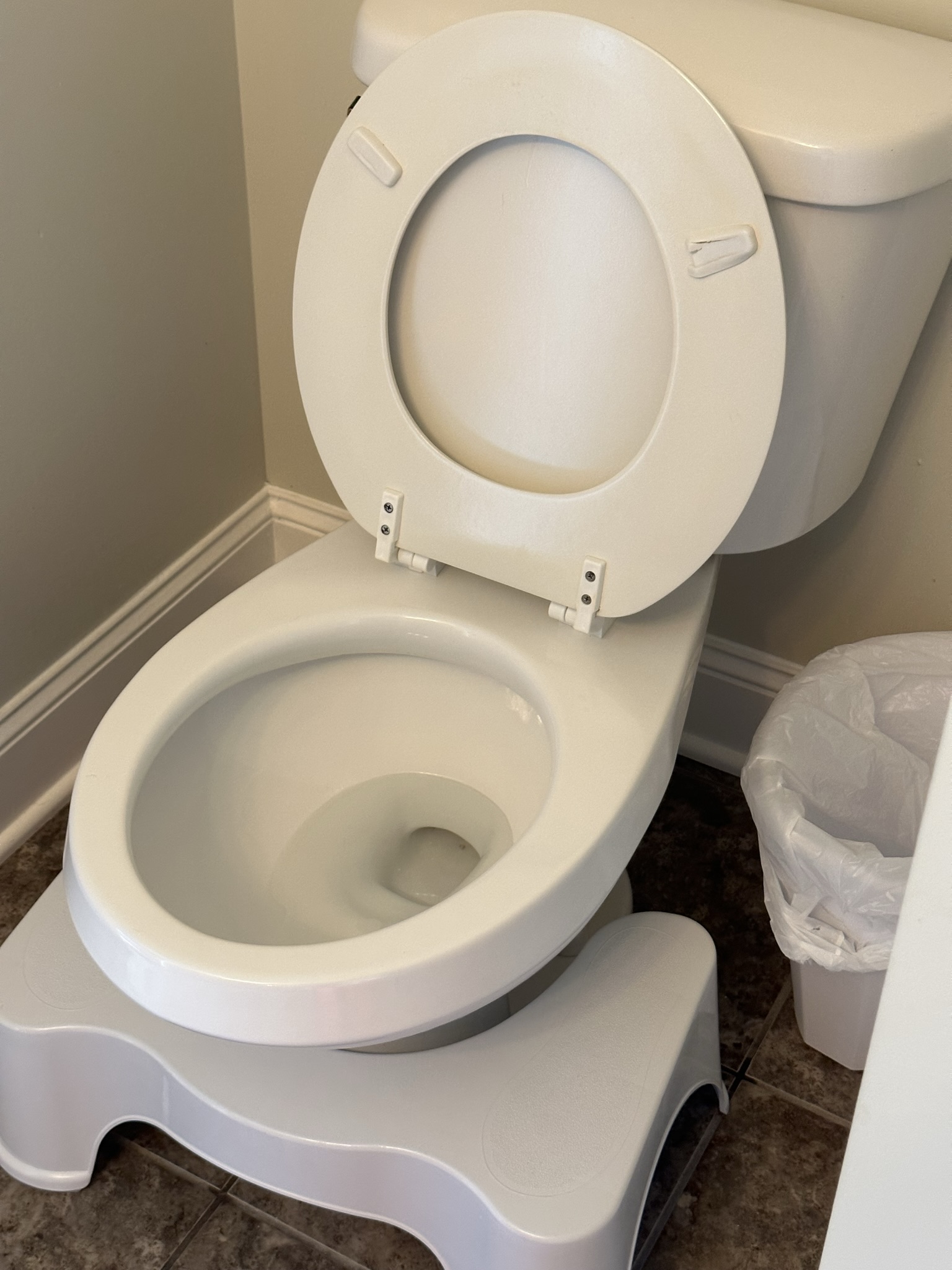Bathroom toilet before cleaning